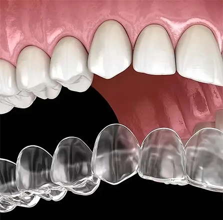 L'orthodontie, c'est <strong>seulement pour les enfants ?</strong>