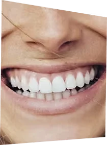 Das perfekte Lächeln